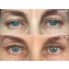 science-serum-tight-eye-clinical-anti-aging-eye-serum-sverige-3