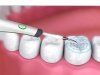 tandstensborttagning-hemma-tandrengoring-sonisk-tandpolering-vitare-tänder-2