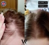 watermans-hair-growth-vital-set-schampo-balsam-conditioner-vitamin-sverige-3