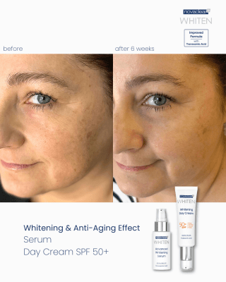 Whitening Night Cream