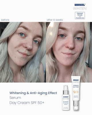 Whitening Night Cream