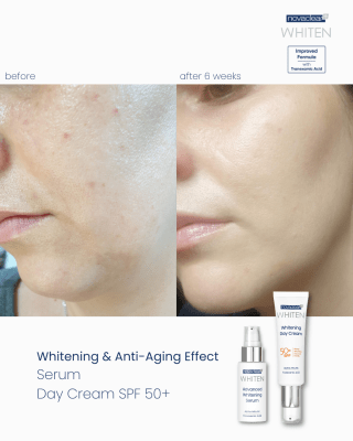 novaclear-whitening-day-cream-spf50-3