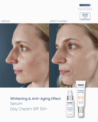 Whitening Night Cream