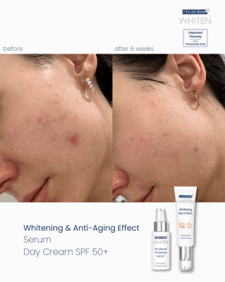 novaclear-whitening-day-cream-spf50-7