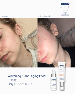 novaclear-whitening-day-cream-spf50-5