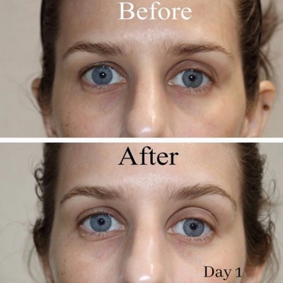 science-serum-bright-and-tight-sverige-2