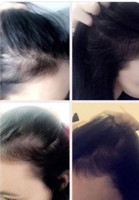 watermans-shampoo-schampo-hair-growth-me-sverige-motverkar-haravfall-5