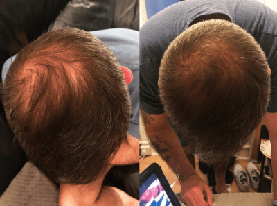 watermans-3x-schampo-3x-balsam-kit-hairgrowth-harvaxtschampo-hair-growth-shampo-conditioner-kit-sverige-3